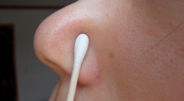 Easily-Get-Rid-of-Blackheads-Naturally-at-Home-Remedy