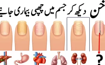 Healthy-Nails