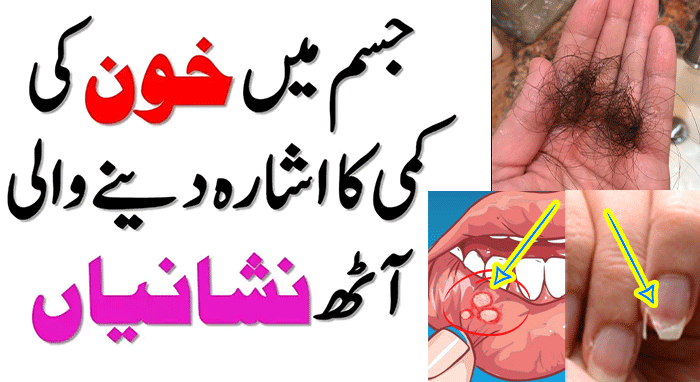 How to Get Rid of Anemia Iron Deficiency with Supplements and Home Remedies