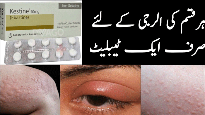 Kestine Tablet Uses In Urdu, کیسٹین ٹیبلٹ الرجی کا مکمل علاج