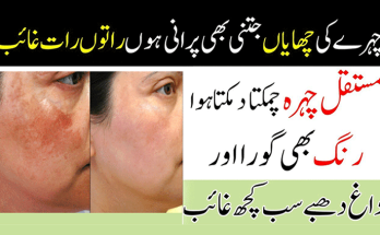 Pigmentation Treatment on Face