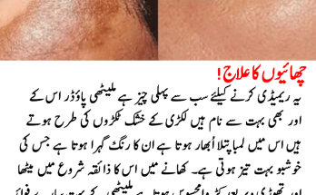 Pigmentation and Melasma Treatment Naturally with Home Remedy