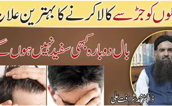 Premature Gray Hair Causes and Solutions with Lifestyle Modifications
