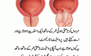 Prostate Causes, Symptoms and Treatment Options for Prostate Cancer