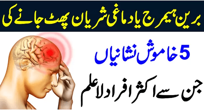 Silent Signs of Brain Hemorrhage