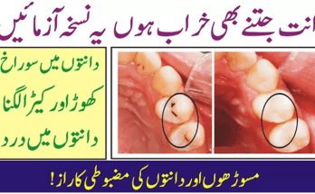 Prevent Gum Disease